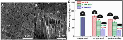 The Improvement in Surface Properties of Metallic Implant via Magnetron Sputtering: Recent Progress and Remaining Challenges